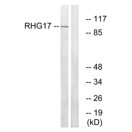 Western Blot - Anti-RHG17 Antibody (C18367) - Antibodies.com