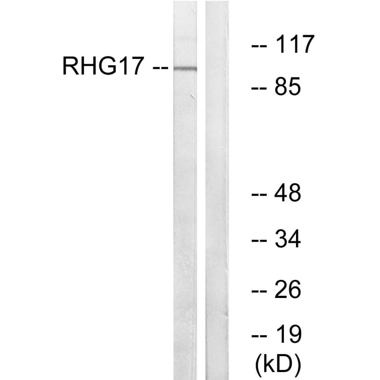 Western Blot - Anti-RHG17 Antibody (C18367) - Antibodies.com