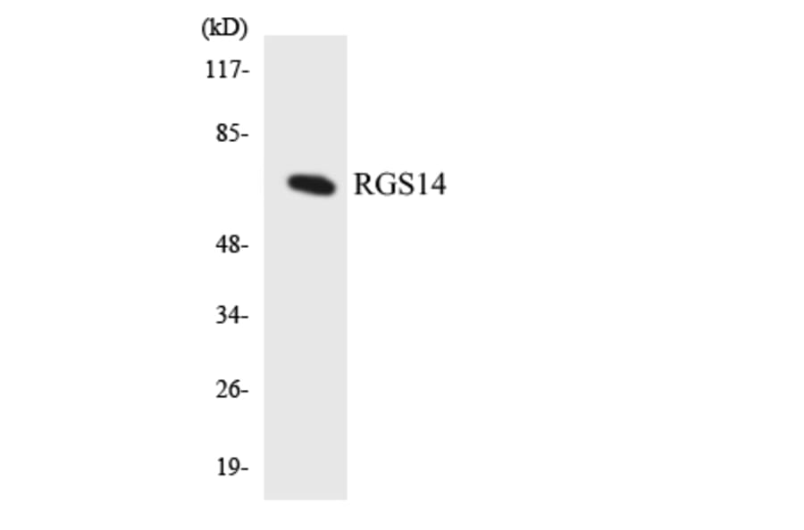 Western Blot - Anti-RGS14 Antibody (R12-3434) - Antibodies.com