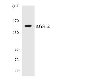 Western Blot - Anti-RGS12 Antibody (R12-3433) - Antibodies.com