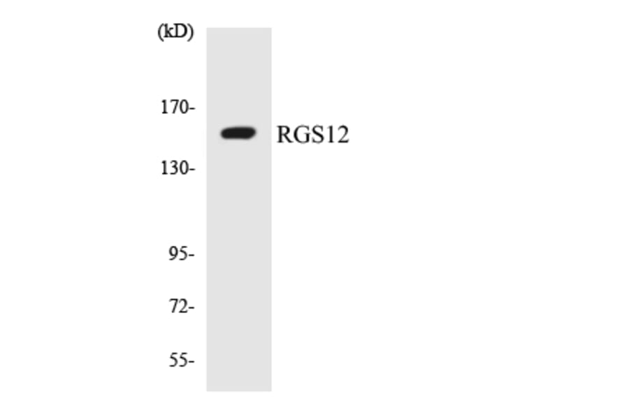 Western Blot - Anti-RGS12 Antibody (R12-3433) - Antibodies.com