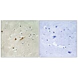 Immunohistochemistry - Anti-RGAP1 Antibody (C11673) - Antibodies.com