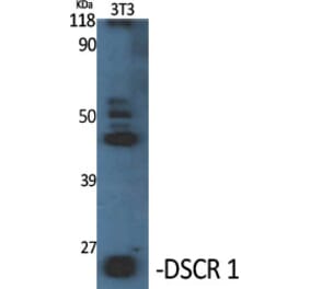 Western Blot - Anti-RCAN1 Antibody (C14815) - Antibodies.com