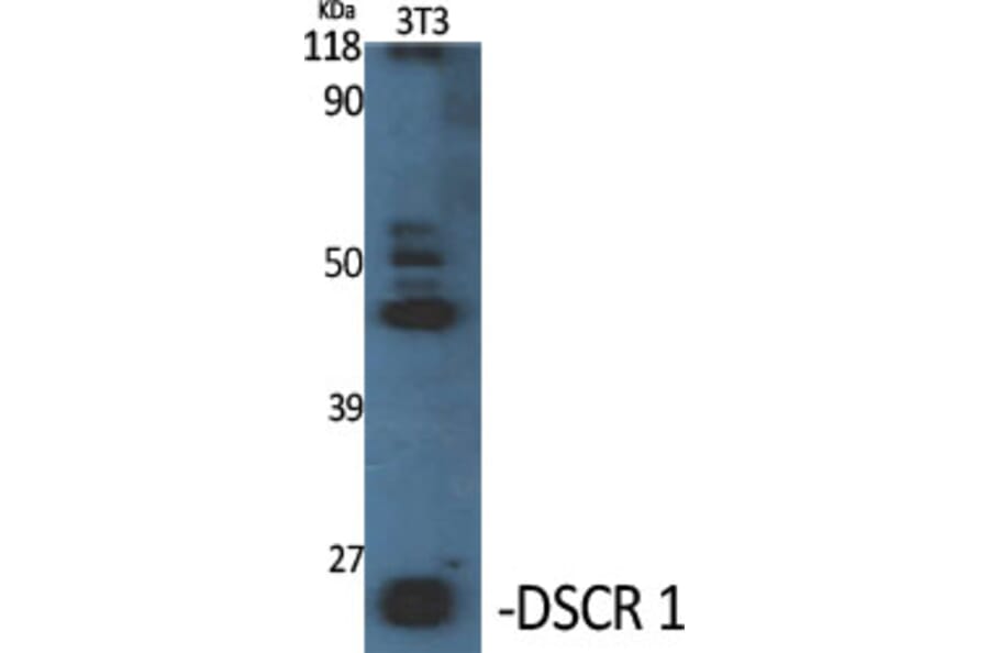 Western Blot - Anti-RCAN1 Antibody (C14815) - Antibodies.com