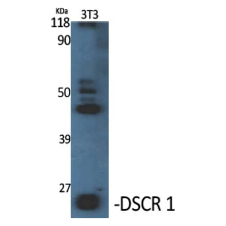 Western Blot - Anti-RCAN1 Antibody (C14815) - Antibodies.com