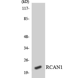 Western Blot - Anti-RCAN1 Antibody (R12-3412) - Antibodies.com