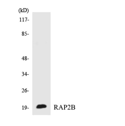 Western Blot - Anti-RAP2B Antibody (R12-3402) - Antibodies.com
