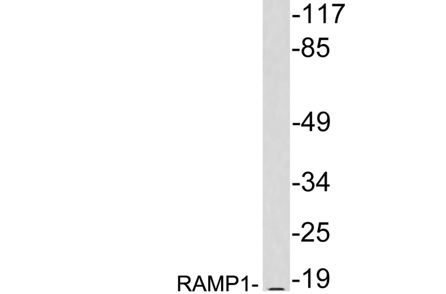 Western Blot - Anti-RAMP1 Antibody (R12-2328) - Antibodies.com