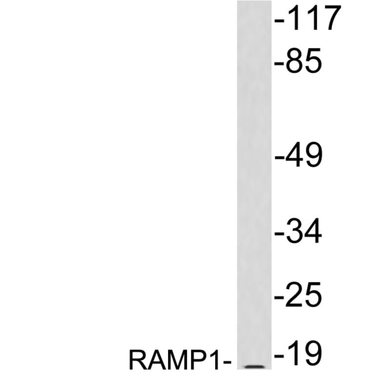 Western Blot - Anti-RAMP1 Antibody (R12-2328) - Antibodies.com