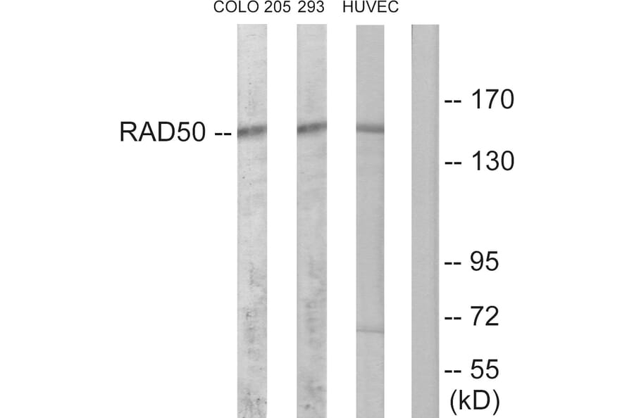 Western Blot - Anti-RAD50 Antibody (C13111) - Antibodies.com