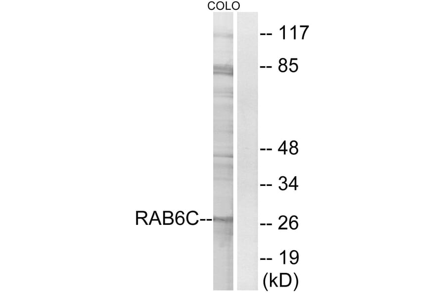 Western Blot - Anti-RAB6C Antibody (C18268) - Antibodies.com
