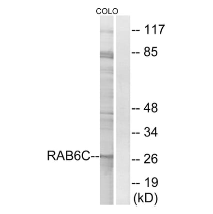 Western Blot - Anti-RAB6C Antibody (C18268) - Antibodies.com