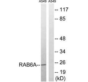 Western Blot - Anti-RAB6A Antibody (C18266) - Antibodies.com