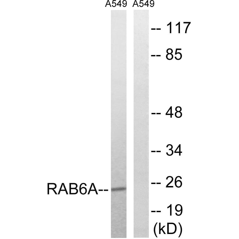 Western Blot - Anti-RAB6A Antibody (C18266) - Antibodies.com