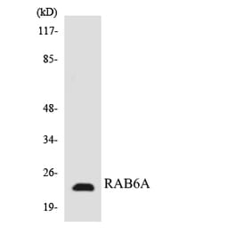 Western Blot - Anti-RAB6A Antibody (R12-3393) - Antibodies.com