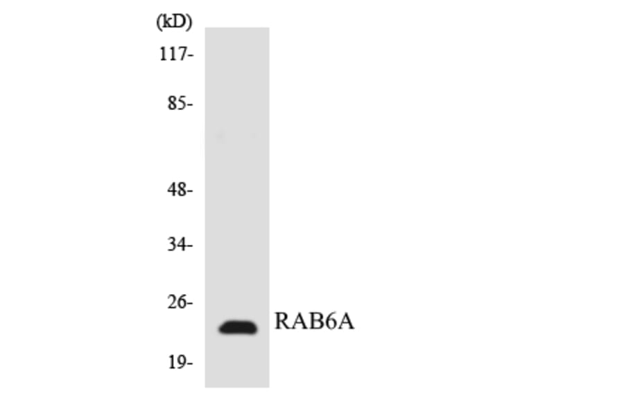 Western Blot - Anti-RAB6A Antibody (R12-3393) - Antibodies.com