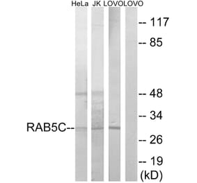 Western Blot - Anti-RAB5C Antibody (C18265) - Antibodies.com