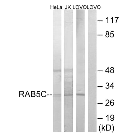 Western Blot - Anti-RAB5C Antibody (C18265) - Antibodies.com