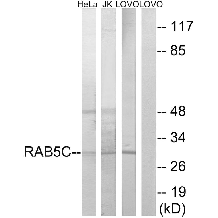 Western Blot - Anti-RAB5C Antibody (C18265) - Antibodies.com