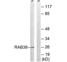 Western Blot - Anti-RAB38 Antibody (C18248) - Antibodies.com