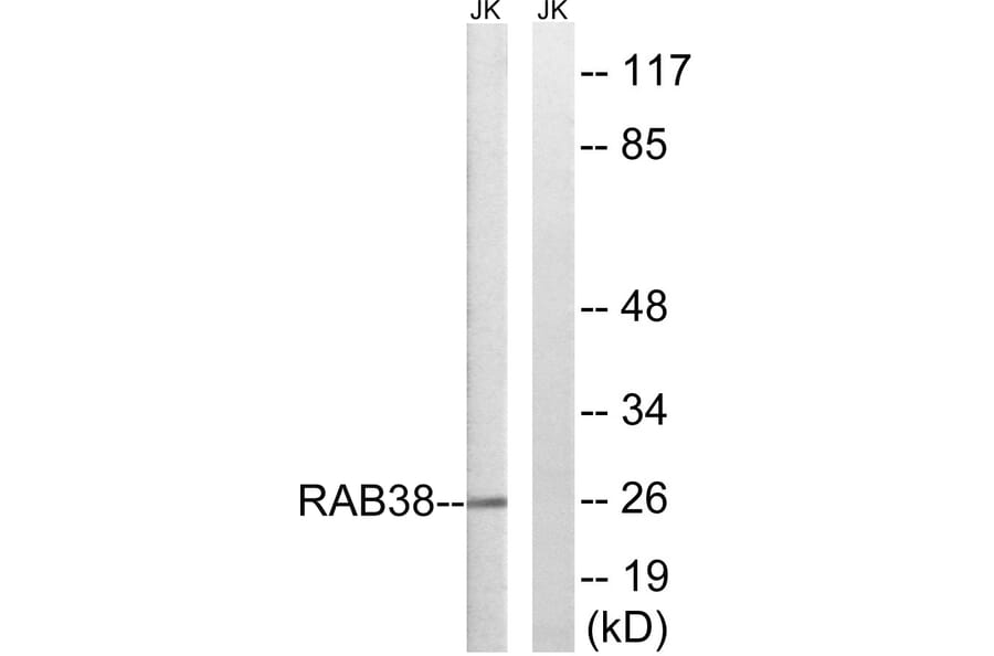 Western Blot - Anti-RAB38 Antibody (C18248) - Antibodies.com