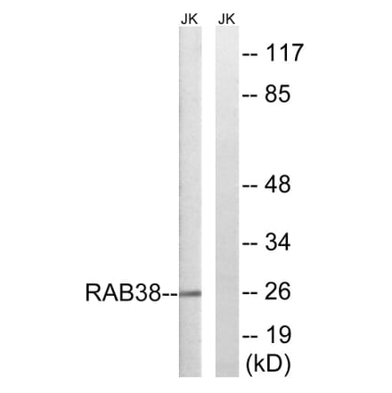 Western Blot - Anti-RAB38 Antibody (C18248) - Antibodies.com