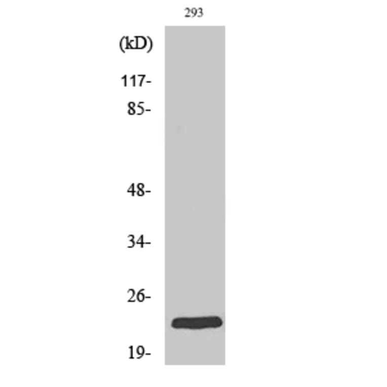 Western Blot - Anti-RAB35 Antibody (C18245) - Antibodies.com