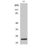 Western Blot - Anti-RAB35 Antibody (C18245) - Antibodies.com