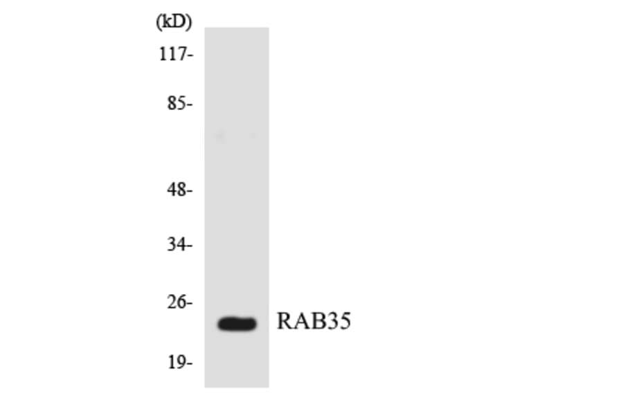 Western Blot - Anti-RAB35 Antibody (R12-3390) - Antibodies.com