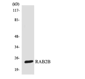 Western Blot - Anti-RAB2B Antibody (R12-3389) - Antibodies.com