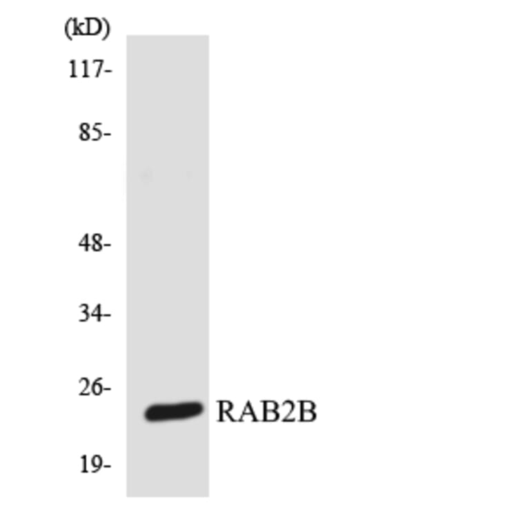 Western Blot - Anti-RAB2B Antibody (R12-3389) - Antibodies.com