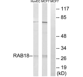 Western Blot - Anti-RAB18 Antibody (C18223) - Antibodies.com