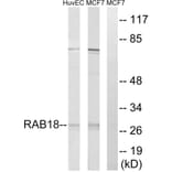Western Blot - Anti-RAB18 Antibody (C18223) - Antibodies.com
