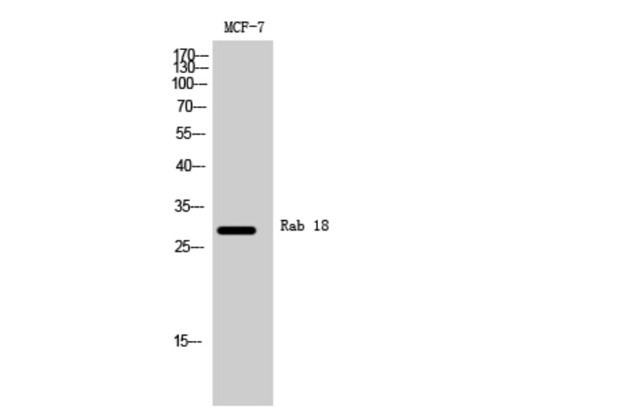 Western Blot - Anti-RAB18 Antibody (C18223) - Antibodies.com