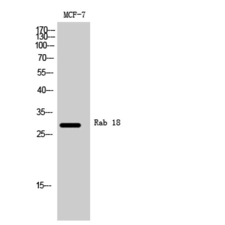 Western Blot - Anti-RAB18 Antibody (C18223) - Antibodies.com