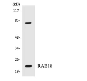 Western Blot - Anti-RAB18 Antibody (R12-3387) - Antibodies.com