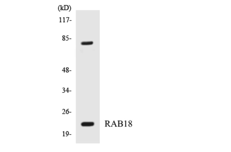 Western Blot - Anti-RAB18 Antibody (R12-3387) - Antibodies.com
