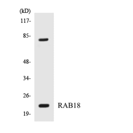 Western Blot - Anti-RAB18 Antibody (R12-3387) - Antibodies.com