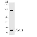 Western Blot - Anti-RAB18 Antibody (R12-3387) - Antibodies.com