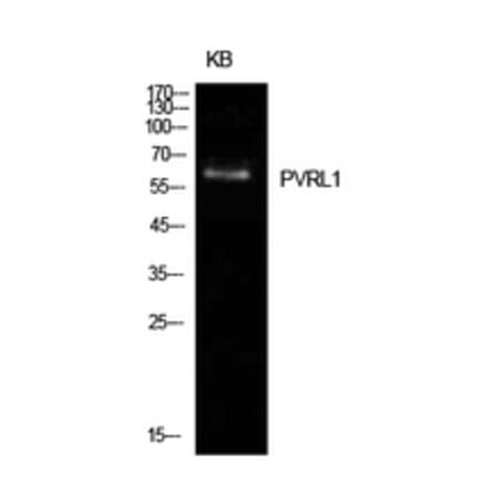 Western Blot - Anti-PVRL1 Antibody (C30415) - Antibodies.com