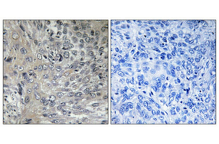 Immunohistochemistry - Anti-PSMD2 Antibody (C10956) - Antibodies.com