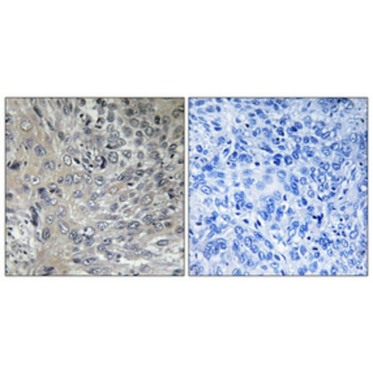 Immunohistochemistry - Anti-PSMD2 Antibody (C10956) - Antibodies.com