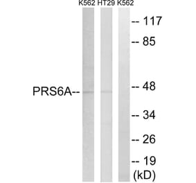 Western Blot - Anti-PRS6A Antibody (C14013) - Antibodies.com