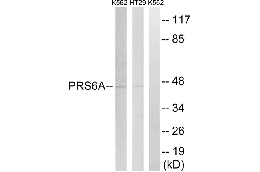 Western Blot - Anti-PRS6A Antibody (C14013) - Antibodies.com