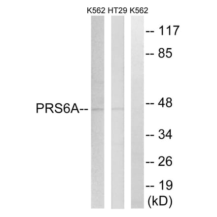 Western Blot - Anti-PRS6A Antibody (C14013) - Antibodies.com