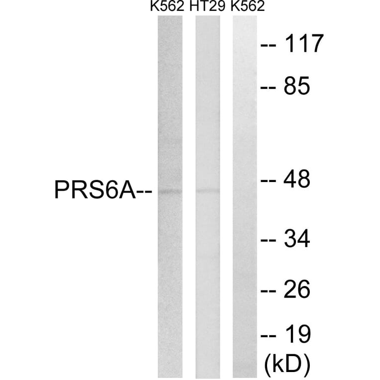 Western Blot - Anti-PRS6A Antibody (C14013) - Antibodies.com
