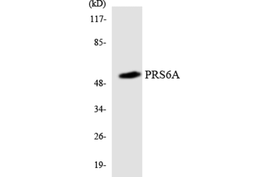 Western Blot - Anti-PRS6A Antibody (R12-3374) - Antibodies.com