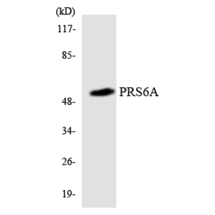 Western Blot - Anti-PRS6A Antibody (R12-3374) - Antibodies.com
