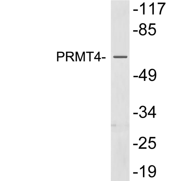 Western Blot - Anti-PRMT4 Antibody (R12-2321) - Antibodies.com