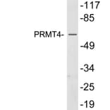 Western Blot - Anti-PRMT4 Antibody (R12-2321) - Antibodies.com